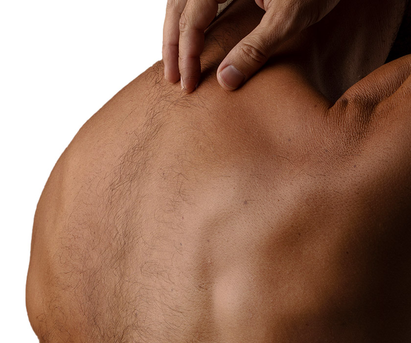 Hairy Back